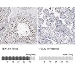 Merck Anti-TEX12 antibody produced in rabbit
