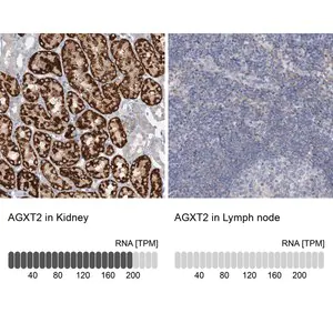 Merck Anti-AGXT2 antibody produced in rabbit