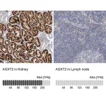 Merck Anti-AGXT2 antibody produced in rabbit