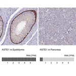 Merck Anti-ASTE1 antibody produced in rabbit