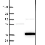 Merck Anti-FGFR1OP2 antibody produced in rabbit