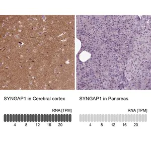 Merck Anti-SYNGAP1 antibody produced in rabbit