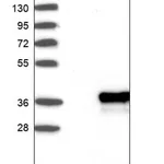 Merck Anti-ZCCHC9 antibody produced in rabbit