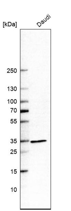 Merck Anti-HADH antibody produced in rabbit