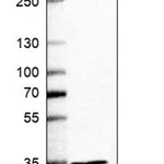 Merck Anti-HADH antibody produced in rabbit