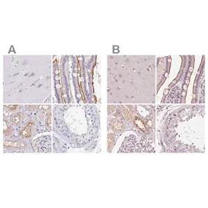Merck Anti-TREH antibody produced in rabbit
