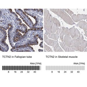 Merck Anti-TCTN2 antibody produced in rabbit