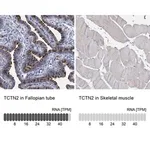Merck Anti-TCTN2 antibody produced in rabbit