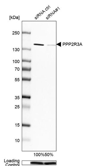 Merck Anti-PPP2R3A antibody produced in rabbit