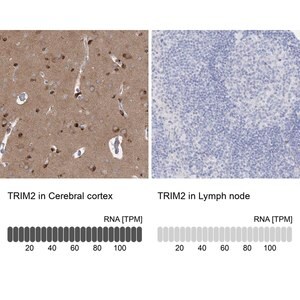 Merck Anti-TRIM2 antibody produced in rabbit