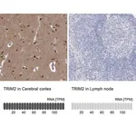 Merck Anti-TRIM2 antibody produced in rabbit