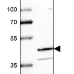 Merck Anti-RANBP3L antibody produced in rabbit