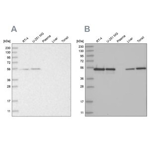 Merck Anti-RBM17 antibody produced in rabbit