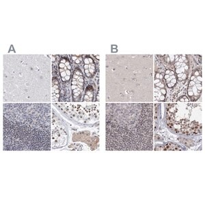 Merck Anti-UIMC1 antibody produced in rabbit