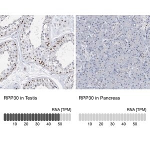 Merck Anti-RPP30 antibody produced in rabbit