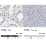 Merck Anti-RPP30 antibody produced in rabbit