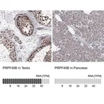 Merck Anti-PRPF40B antibody produced in rabbit