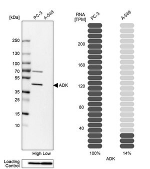 Merck Anti-ADK antibody produced in rabbit