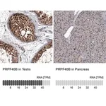 Merck Anti-PRPF40B antibody produced in rabbit