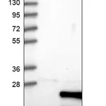 Merck Anti-TSEN15 antibody produced in rabbit