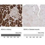 Merck Anti-BDH2 antibody produced in rabbit