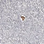 Merck Anti-SMYD4 antibody produced in rabbit