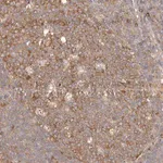 Merck Anti-EPRS antibody produced in rabbit