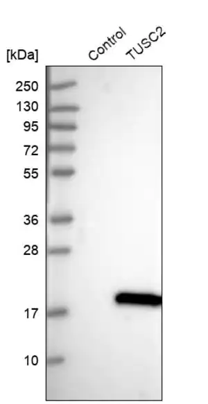 Merck Anti-TUSC2 antibody produced in rabbit