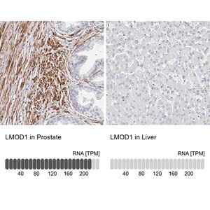 Merck Anti-LMOD1 antibody produced in rabbit