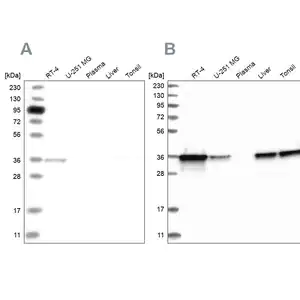 Merck Anti-PDXK antibody produced in rabbit