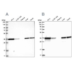 Merck Anti-PDXK antibody produced in rabbit