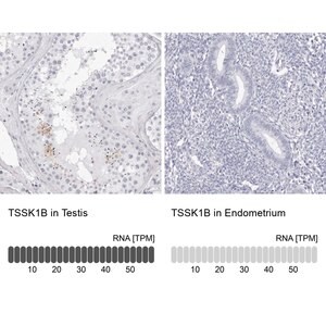Merck Anti-TSSK1B antibody produced in rabbit