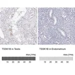 Merck Anti-TSSK1B antibody produced in rabbit