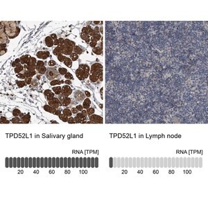Merck Anti-TPD52L1 antibody produced in rabbit