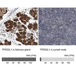 Merck Anti-TPD52L1 antibody produced in rabbit