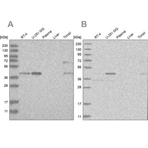 Merck Anti-RTCA antibody produced in rabbit