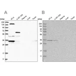 Merck Anti-PPP1R42 antibody produced in rabbit