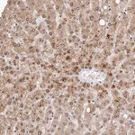 Merck Anti-SULT1E1 antibody produced in rabbit