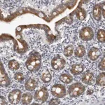 Merck Anti-CPT2 antibody produced in rabbit