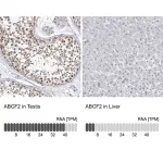 Merck Anti-ABCF2 antibody produced in rabbit
