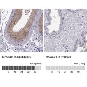 Merck Anti-MAGEB4 antibody produced in rabbit