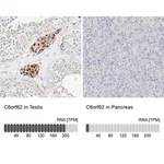 Merck Anti-C6orf62 antibody produced in rabbit