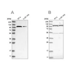 Merck Anti-OGT antibody produced in rabbit
