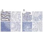 Merck Anti-C1orf87 antibody produced in rabbit