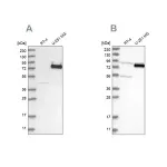 Merck Anti-COLGALT2 antibody produced in rabbit