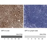 Merck Anti-GPT antibody produced in rabbit
