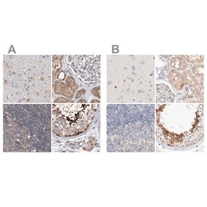 Merck Anti-SPATA20 antibody produced in rabbit