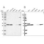 Merck Anti-RPA2 antibody produced in rabbit