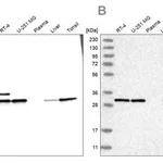 Merck Anti-RPA2 antibody produced in rabbit