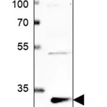 Merck Anti-PLEKHF2 antibody produced in rabbit